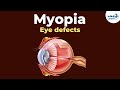 Understanding Myopia and Eye Function