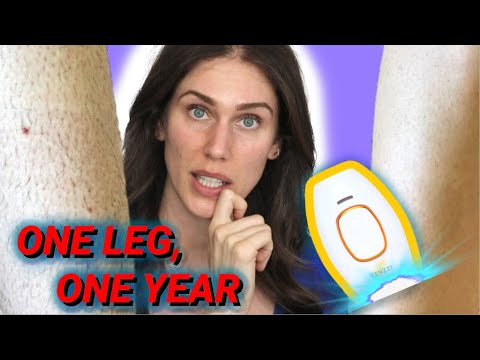 I Shot Intense Pulsed Light Into My Leg For 1 Year And this Is What Happened To My Hairs...