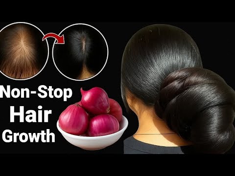 ১ মাসের মধ্যে চুল লম্বা করতে চাও? চুল পড়া কমবে ❌ নতুন চুল গজাবে ✅💯