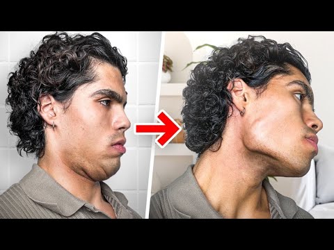 How to get a Chiseled Jawline (NO BS GUIDE)