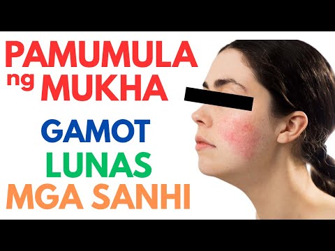 🔴 Pamumula ng MUKHA - Gamot, LUNAS, at mga posibleng SANHI | Home Remedies