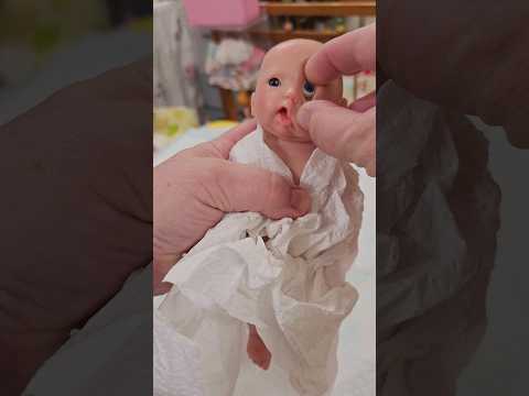 Eye Surgery for Baby #shorts