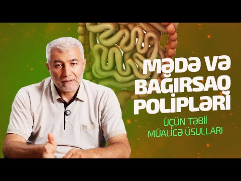 Mədə və bağırsaq poliplərinin təbii müalicəsi - Fizuli Hüseynov