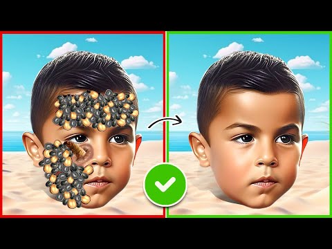 Cristiano Ronaldo | ASMR remove ticks and maggots from Ronaldo Jr | severely injured treatment