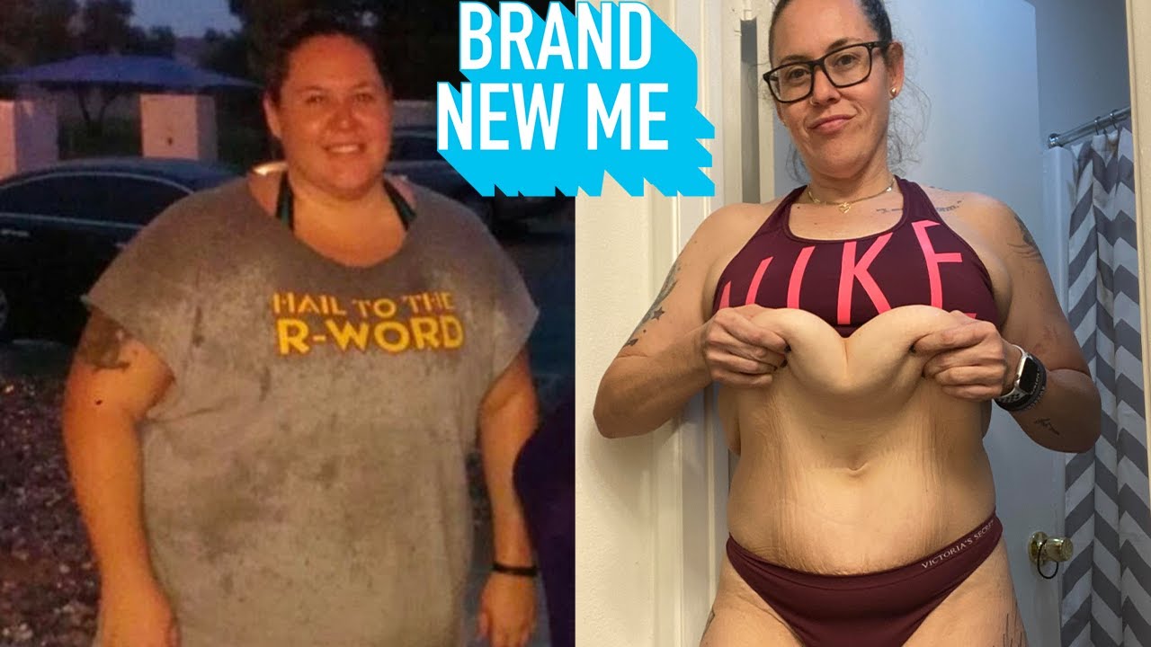 Lost 200lbs, removed my excess skin - look at me now - brand new me