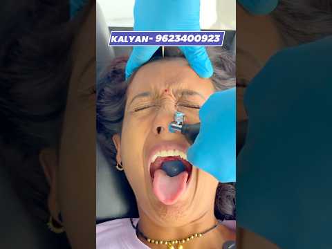CFR for Facial Pain #chiropractor #cor #reelsvideo #reelsviral #migraine #virals #trending
