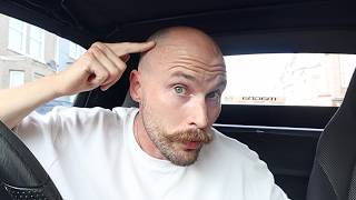 How to get comfortable with the Balding "Grandpa Ring"