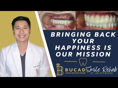 BRINGING BACK YOUR HAPPINESS IS OUR MISSION 3D PRINTED DENTURES AND BRIDGE WITH 6 DENTAL IMPLANTS