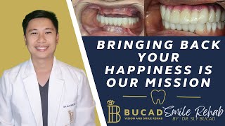 BRINGING BACK YOUR HAPPINESS IS OUR MISSION 3D PRINTED DENTURES AND BRIDGE WITH 6 DENTAL IMPLANTS