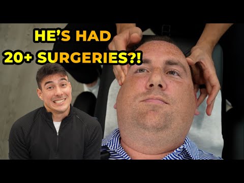 He’s Had How Many Surgeries?