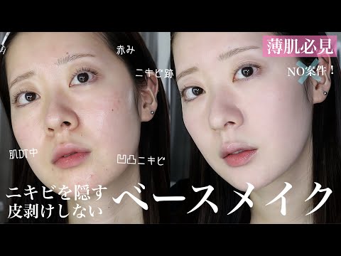 【最新版】ニキビ/肌荒れ/赤みもナチュラルカバー！薄肌でも皮剥けしないベースメイク徹底解説📝【乾燥/敏感肌】