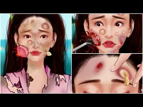 What happened to this girl? Let's help her treat her. asmr