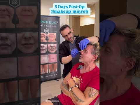 #minrob #мояжизнь #recommended #новости #recovery #beauty #news #мояистория #новостисша #нос