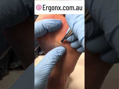 Corn removal at regular speed :) do you find this satusfying ? Do you get one of these? This is from
