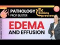 Understanding Edema and Effusion Concepts