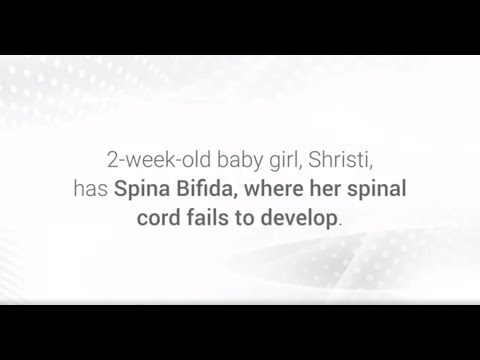 Dr. Shweta Kumari and Team Illuminate Hope for Baby Shrishti with Spinal Bifida