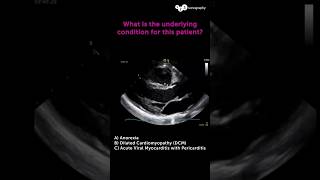 What is the most probable diagnosis? 💡