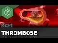 thrombose/