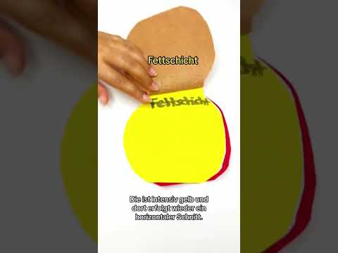 Hattest du schonmal einen Kaiserschnitt? #kaiserschnitt #geburt #gynäkologie #schwangerschaft