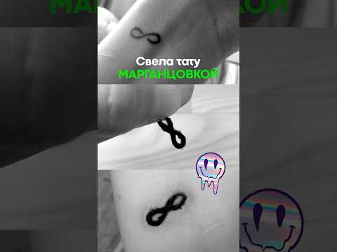 ШРАМ вместо тату #татуировка #тату #шрамирование #tatoo #треш #личныйопыт