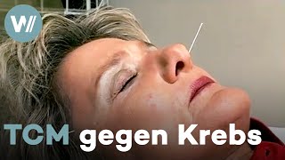 Alkoholismus, Krebs: Die traditionelle chinesische Medizin kann helfen!