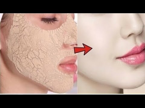 इस चीज को लगाते ही चेहरा इतना गोरा बेदाग हो जायेगा की देखकर हैरान हो जाओगे Skin Whitening Instantly