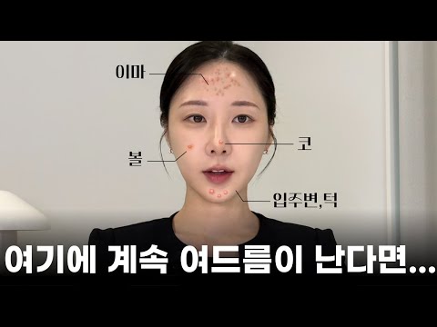 내가 유독 여기에 여드름이 났던 이유