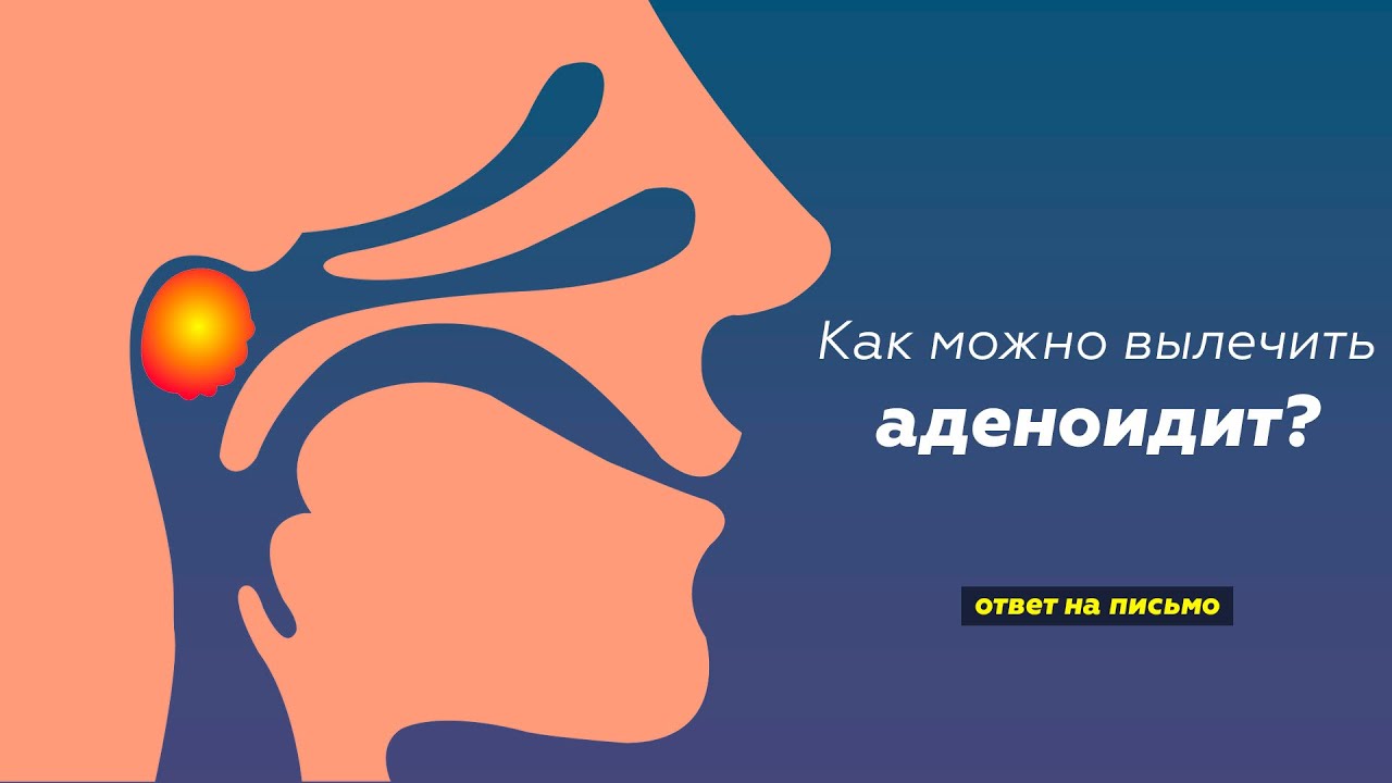 Как можно вылечить аденоидит?