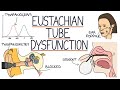 Eustachian Tube Function and Dysfunction