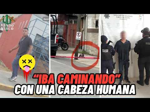 😱 ¡Aterrador! Detienen a sujeto que paseaba con una cabeza  en #Veracruz 🚔