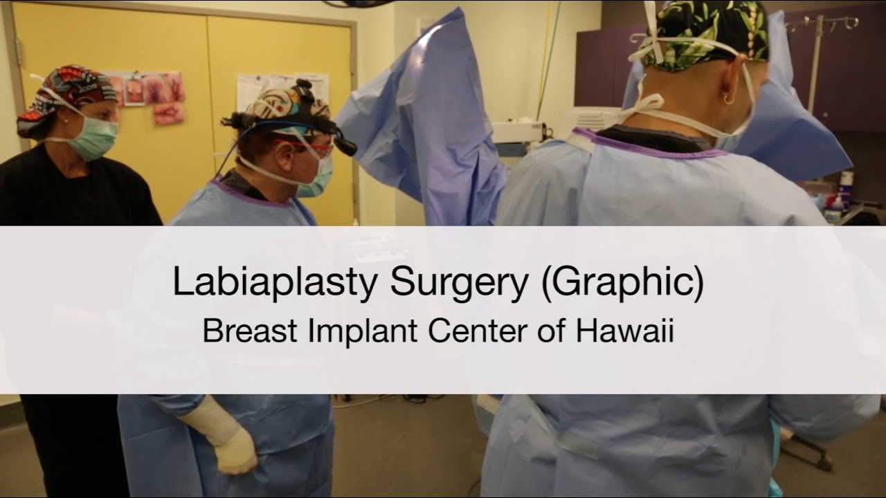 S. Larry Schlesinger, MD, FACS Performs Labiaplasty Surgery (Vaginal Rejuvenation) Using The Wedge Technique - Breast Implant Center of Hawaii