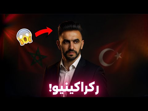 وليد الركراكي يرد على المنتقدين: سأذهب إلى تركيا لزراعة الشعر!😱🔥