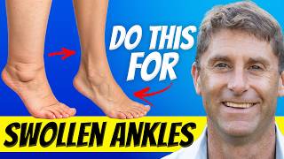 The #1 Way to Eliminate Swollen Legs and Ankles