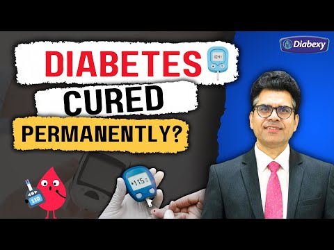 Can Diabetes be Cured Permanently | Diabexy