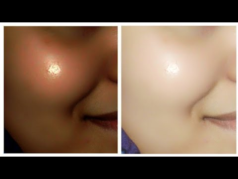 This will make your face so fair in 15 minutes that everyone will keep looking at you | Skin whit...
