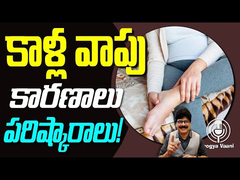 కాళ్ల వాపు: అసలు కారణాలు, ఆయుర్వేద పరిష్కారాలు! #drmuralimanoharchirumamilla