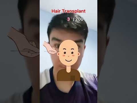 Hair transplant #stickman #animation