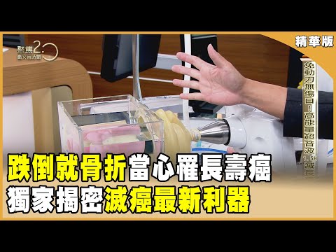 長壽癌九成可治癒！ 最新滅癌武器聚焦亮相！ 「一跌就骨折」當心罹癌前兆【聚焦2.0】第55７集