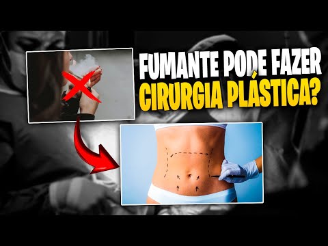 FUMANTE PODE FAZER CIRURGIA PLÁSTICA? A VERDADE QUE VOCÊ PRECISA SABER!