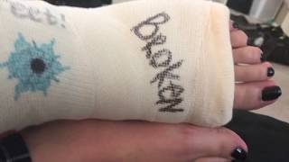 Bootzy signed white leg cast Perfect black nails