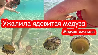 VLOG Ужалила ядовитая медуза