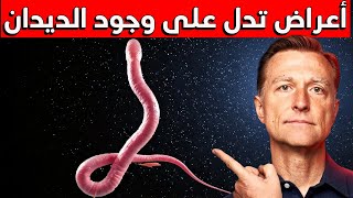 علامات تعني وجود الديدان وكيف تتخلص منها