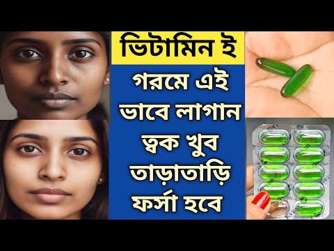 গরমে ভিটামিন E এভাবে লাগান ত্বক খুব তাড়াতাড়ি ফর্সা উজ্জ্বল ঝকঝকে হবে/Vitamin E capsules for face