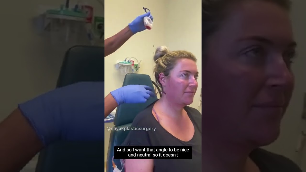 Woman receiving treatment at a plastic surgery clinic.