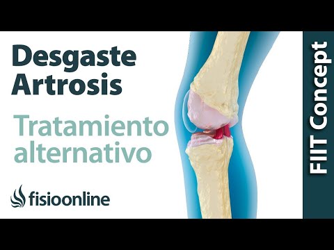 REMEDIOS naturales para la ARTROSIS o desgaste de cartílago