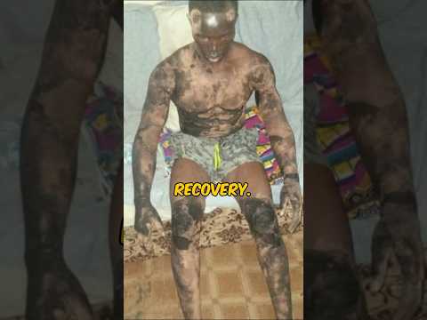 🚨Shocking🚨What happened to this African Bodybuilder😱 #shorts #bodybuilding #gymlife