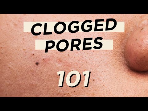 ๐คญEverything you need to know about CLOGGED PORES โข Skincare & makeup products are not the culprit