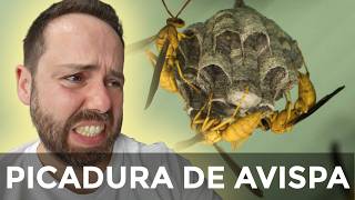 DE QUE ESTA HECHO EL VENENO DE UNA AVISPA