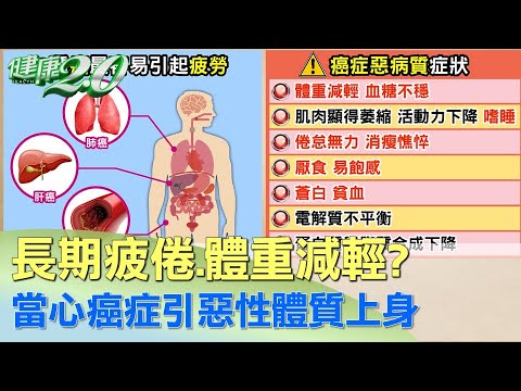 長期疲倦.體重減輕？ 當心癌症引惡性體質上身 健康2.0