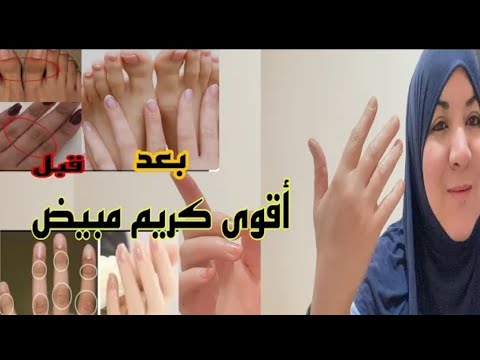 اقوى كريم ومبيض لليدين والقدمين غادي ينفعك في هذا الصيف♥️♥️👍👍🥰